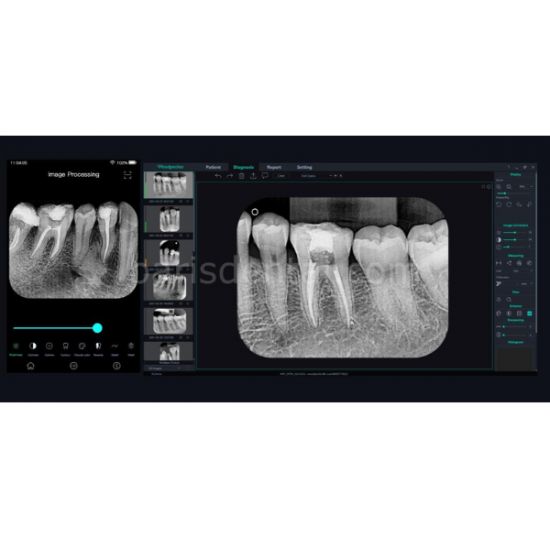 Ai Scan Fosfor Plak Tarayıcısı